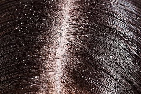 Hair Care Tips