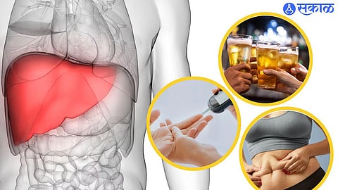 fatty liver disease 