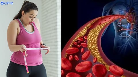 Bad Cholesterol