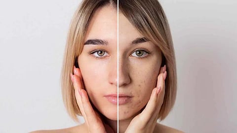 skin