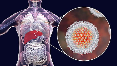 Hepatitis C 