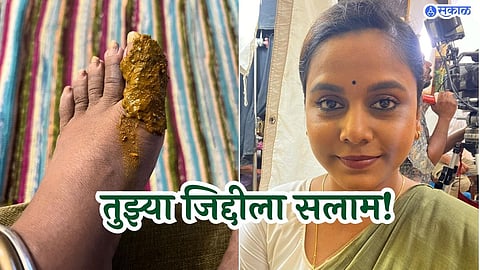 Hemangi kavi shared post about her leg injury after she perform in marathi drama 