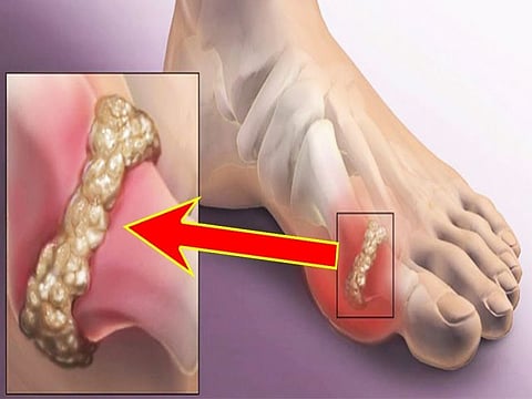 health news 