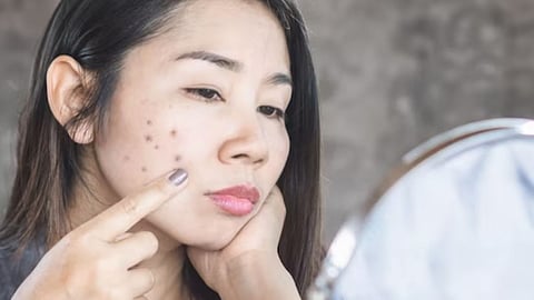 Skin Care