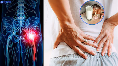 Sciatica 