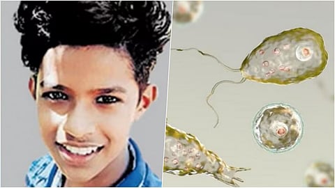 Brain Eating Amoeba