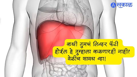 Fatty Liver