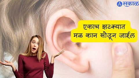 Remedies for Earwax