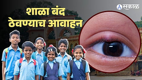 Pune 