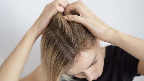 hair 