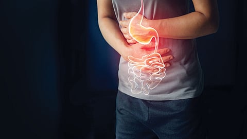 Stomach Cancer