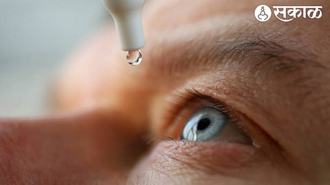 eye droping