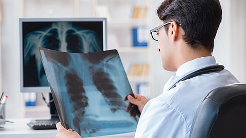 Lung  Cancer