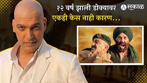 The villain of Gadar 2 manish wadhwa  hasn't grown a single hair on his head for 12 years, here's a reason