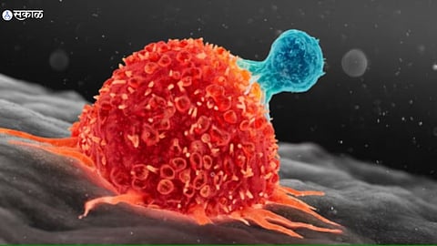 Cancer 