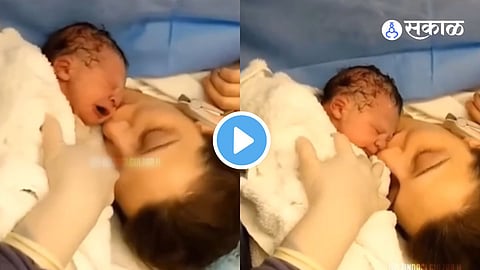 Viral Video