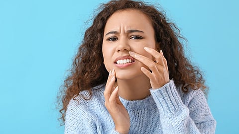 Gum Bleeding