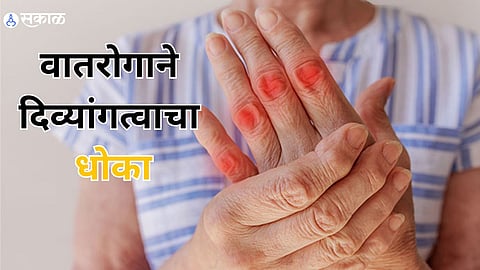 Rheumatoid Arthritis 