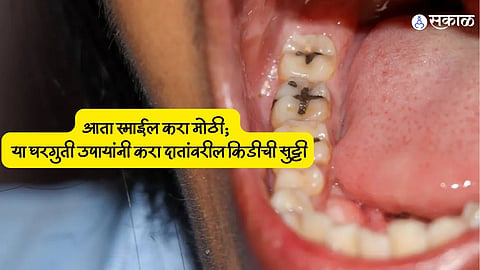 Dental Health Tips 