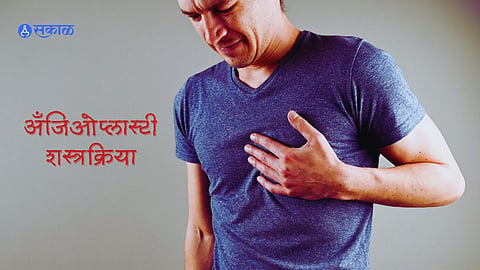 Angioplasty Surgery