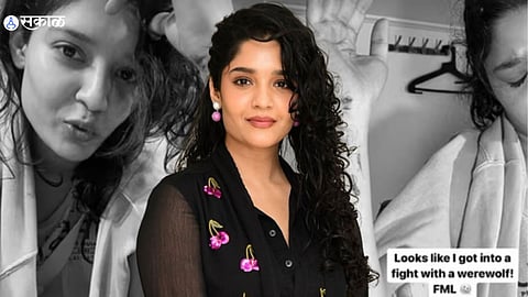 Rajinikanth Co Star Ritika Singh Injured: 