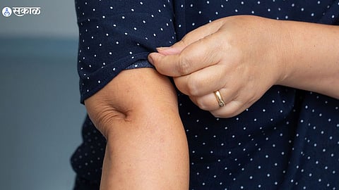 Arm Fat : दंडावरची चरबी जास्तच लटकतेय? रोज फक्त 10 मिनिटे हे व्यायाम करा