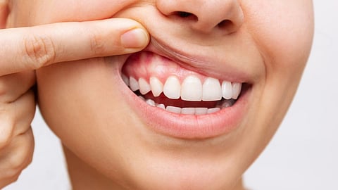 Gums Teeth