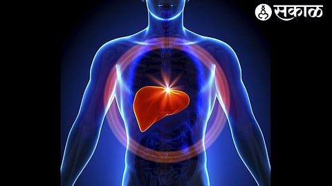 Fatty liver Disease : फॅटी लिव्‍हरचे 35 टक्‍के नागरिक शिकार..! जीवनशैलीतील बदल कारणीभूत
