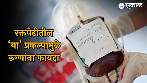 Nagpur Hospital:'रक्त उपलब्ध नाही, असे सांगता येणार नाही', रुग्णालयातील या प्रकल्पामुळे थांबणार रुग्णांची फरपट 