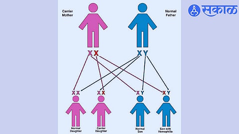 Hemophilia 