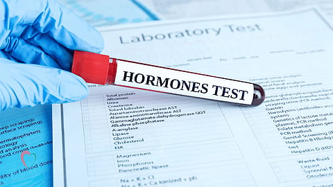 Harmones Testing