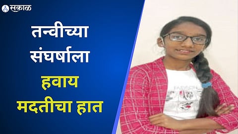 cochlear implant surgery of tanvi kakade sakal foundation