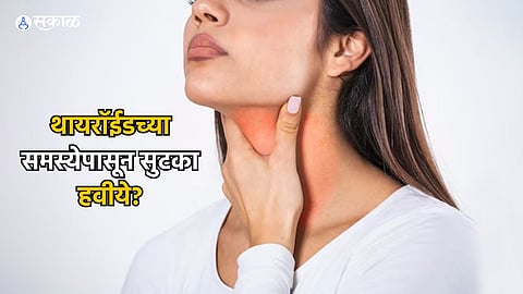 Thyroid 