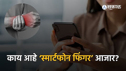 Mobile Finger Pain