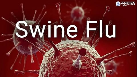 Swine Flu 