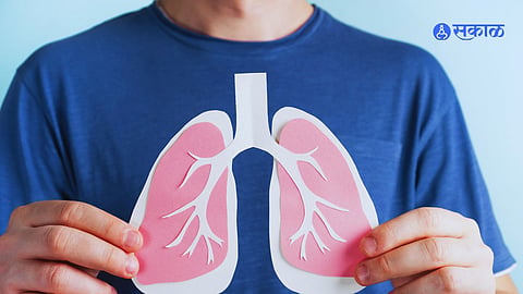 Tuberculosis Disease