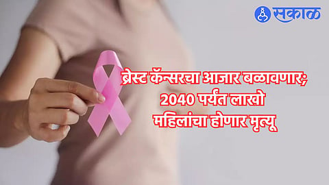 Breast Cancer 