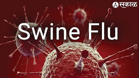 swine flu