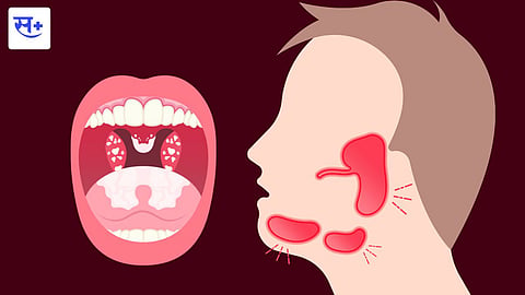 mouth cancer