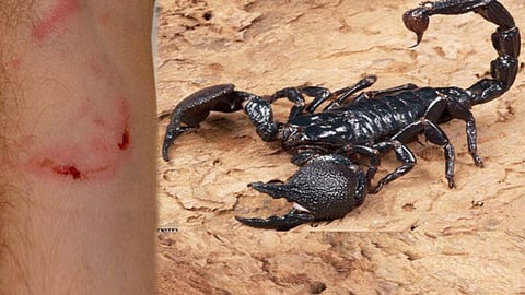 Scorpion Sting