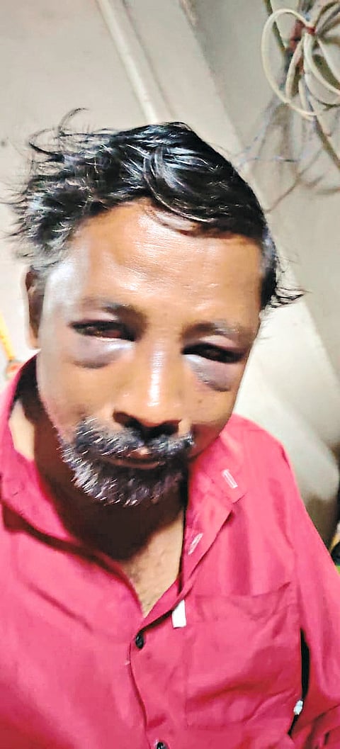 खासगी सावकारीतून नागावच्या  तरुणास बेदम मारहाण