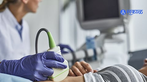 sonography 