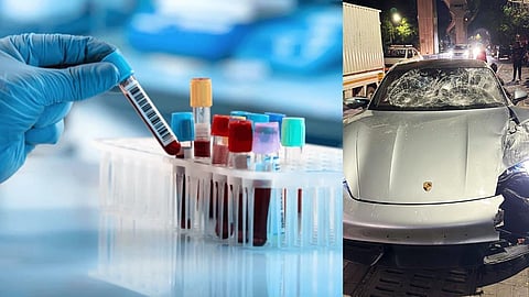 Pune Car Accident Case Blood sample