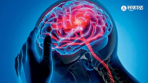World Brain Tumor Day 2024