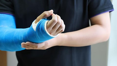 Bone Fracture