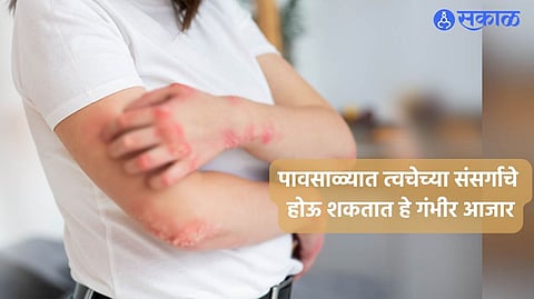 Monsoon Care Tips 
