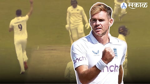 James Anderson 