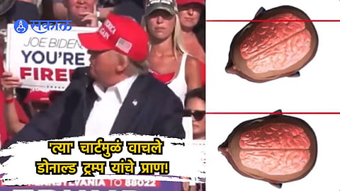Donal Trump