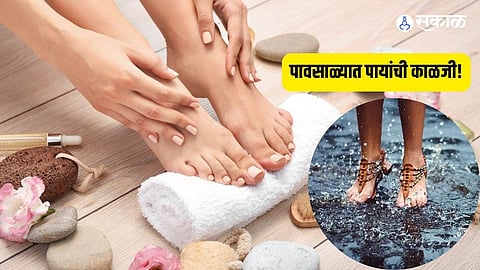 Monsoon Foot Care Tips