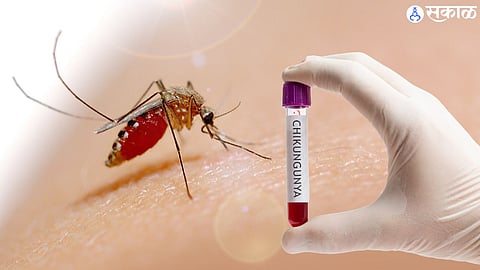 Dengue